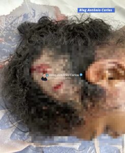 Mulher é ferida com garrafa após discussão em bar de Nova Roma-GO